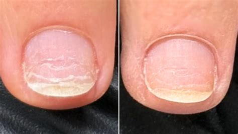 Stronger, Prettier Nails with IBX Nail Treatment NYC