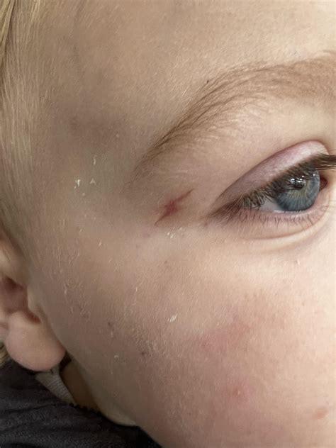 Lightning Strike Scars Fabric & Finery | Charm Silver Lightning Bolt,