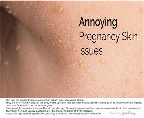 Is Body Hair Normal During Pregnancy at Dylan Schmella blog