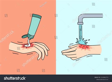 269,955 imágenes de Herida sanando - Imágenes, fotos y vectores de ...