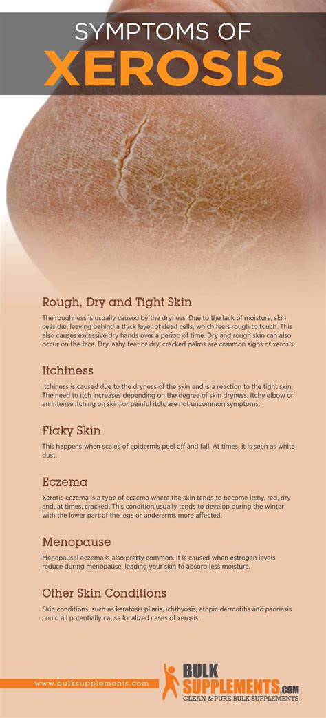 Xerosis Treatment Xerosis (Dry Skin) Dermatology Advisor