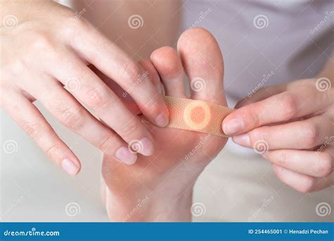Woman Sticks a Medical Plaster To the Plantar Wart of the Leg To Remove ...