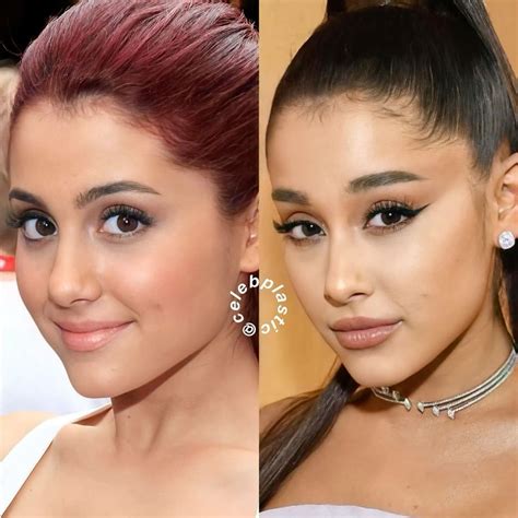 Ariana Grande in 2025 | Ariana grande eyebrows, Celebrity plastic ...