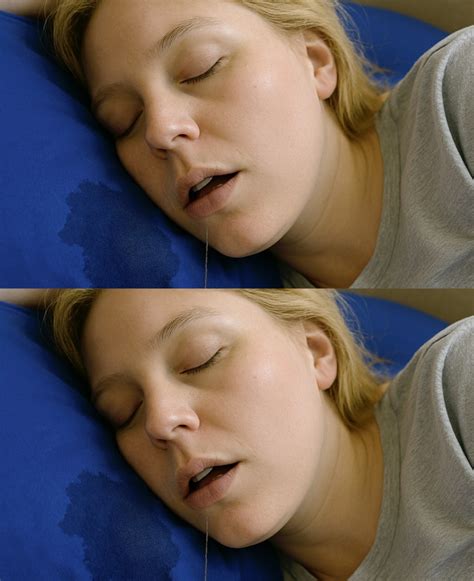 😴 If You Often Drool While Sleeping, Pay Attention to These 6 Causes