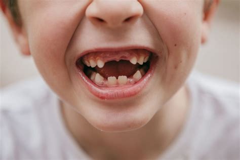 Dreams Of Losing Teeth