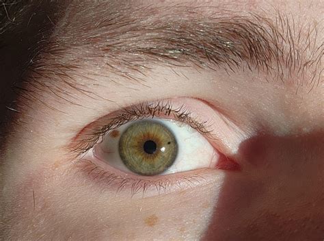 I have a freckle in my eye. : r/eyes