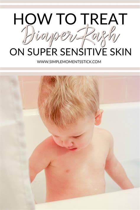 Diaper Rash While Teething at Anthony Tryon blog