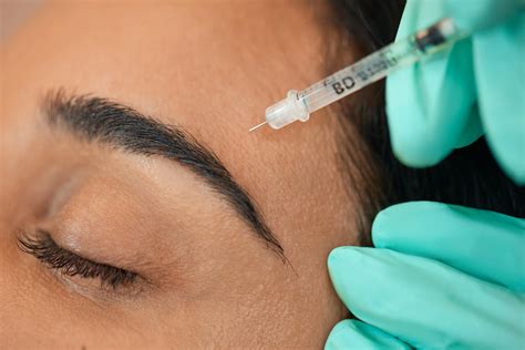 Botox: Before & After Care | The Vanity Lab