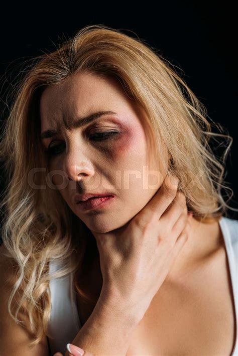 Victim with bruise touching neck isolated on black | Stock image ...