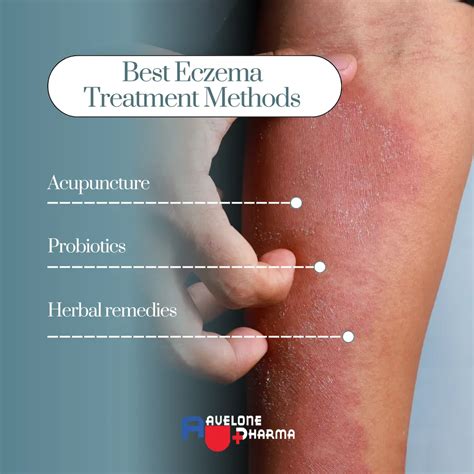 How to Treat Eczema Naturally | Best Remedies for Fast Relief