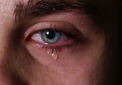 Treatment for Red Watery Eyes - Watery Eye Treatment — The SEE Clinic