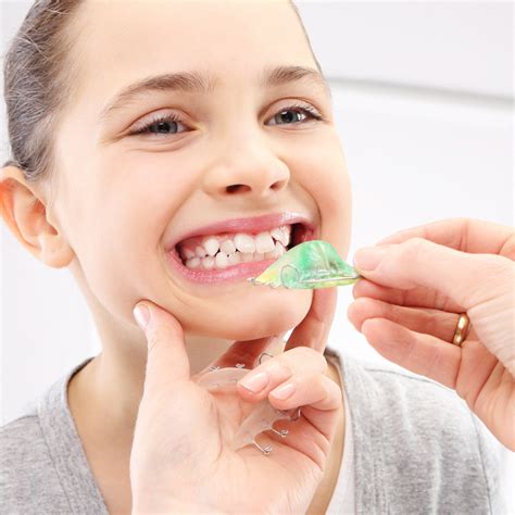 Bunny Teeth: What Causes Buck Teeth? - Bowie Family Dental