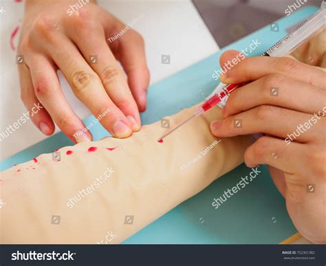 Wide Bore Cannula Coloring Pages [2025]