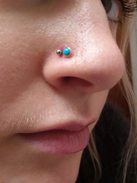 Nose Piercing Keloid On Inside at Florence Crabtree blog
