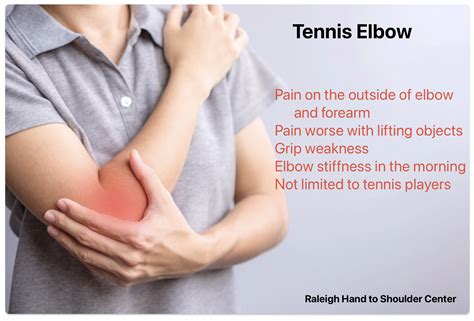 Tennis Elbow Treatment at Raleigh Hand by Dr. Erickson
