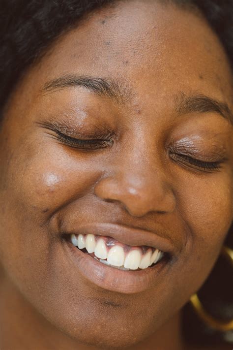 Should I pop my pimple? – Yellow Beauty