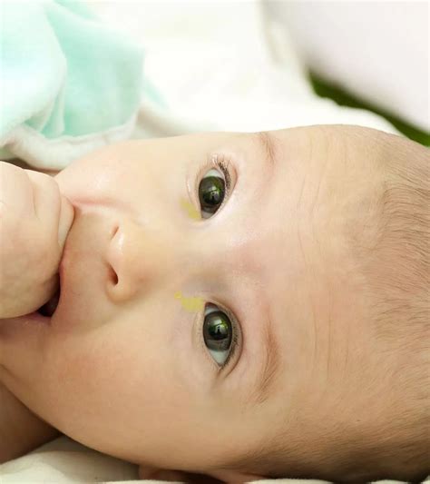 Pink Eye In Babies: Causes, Symptoms & Care Guide