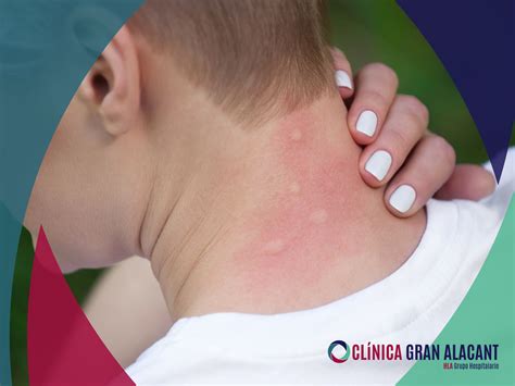 Gran Picadura De Hormiga Negra