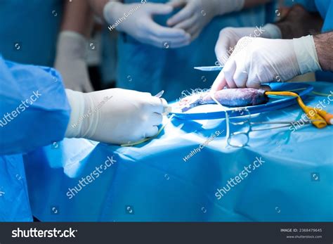 Penis Penile Implant Penis Enlargement Surgery Stock Photo 2368479645 ...