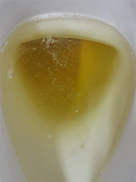 Does anybody's urine look like this too : r/foamyurine