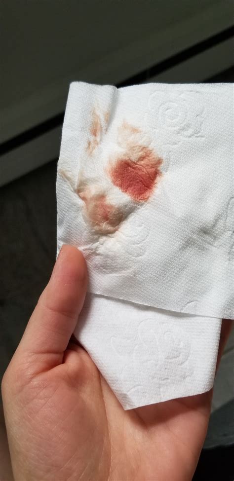 Spotting During Pregnancy