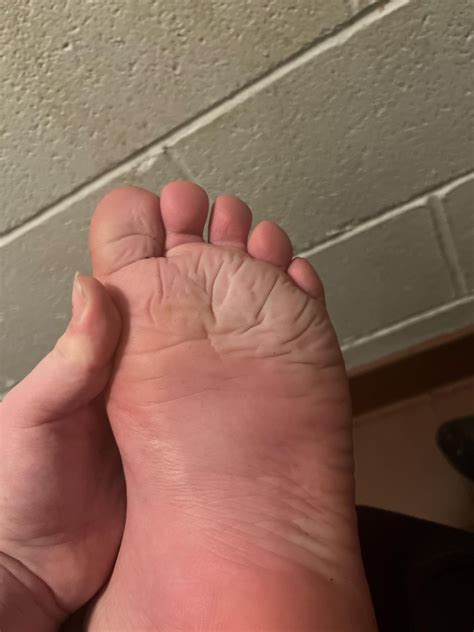 Bump on uvula. Anyone else ever have this? And what was it? : r/DiagnoseMe