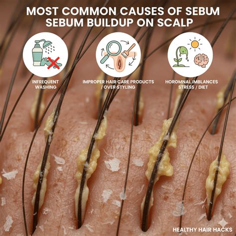 Can Dandruff Be Contagious? Answered by a Doctor – dandRX™