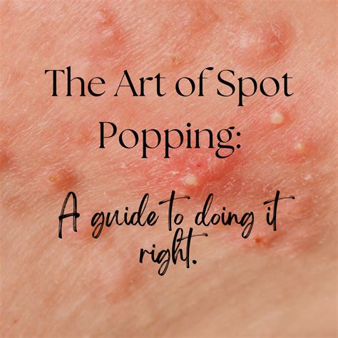 The Art of Popping Spots.