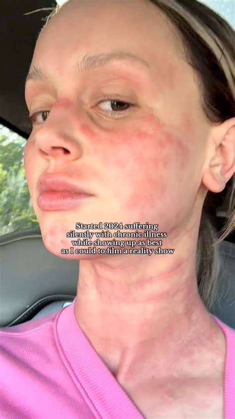 Mikayla Matthews Reflects on 'Removing All Toxic Things' in 2024