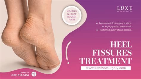 Can You File Cracked Heels at Bertha Prater blog