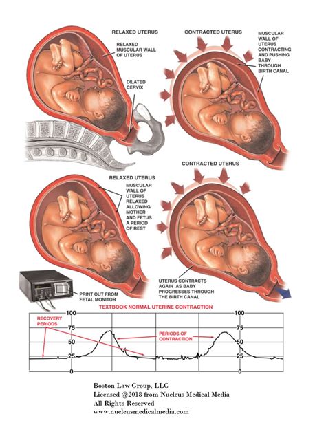 What Is Monitor Uterine Contraction at Gregorio Fields blog