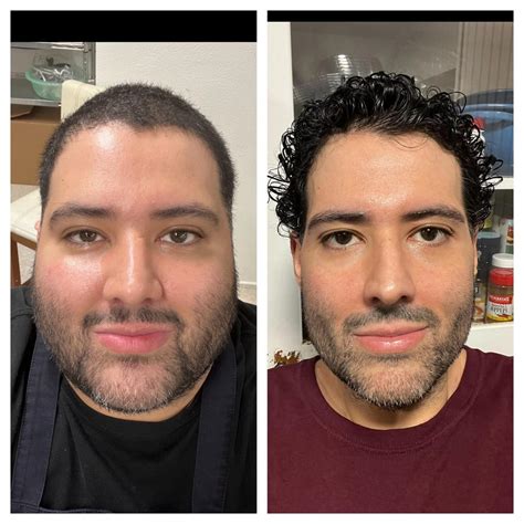 15 months post-op. From 350 to 173 lbs. 177 lbs lost. : r/wls