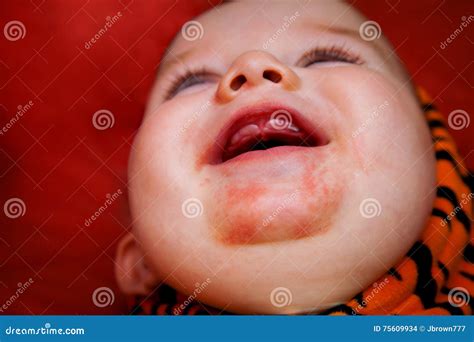 Teething Baby with Drool Rash Stock Photo - Image of expression, copy ...