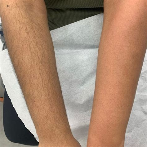 Is It Normal To Wax Your Arms at Christy Redfield blog