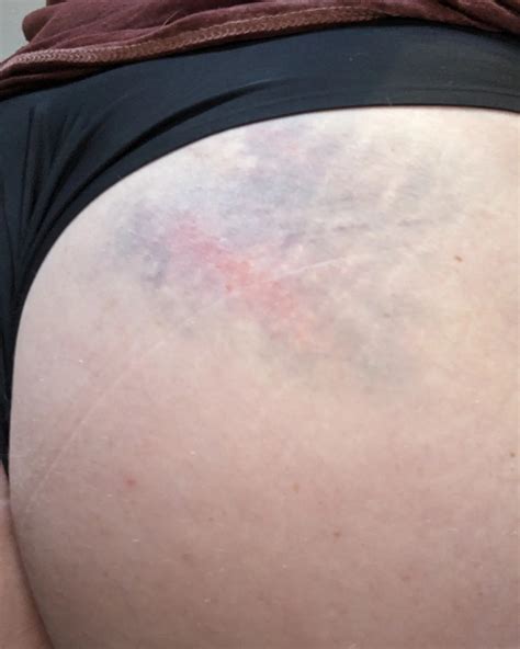 Pinball Little | Look at this beaut! 🍑 Yes, that's my butt. 😘 # ...