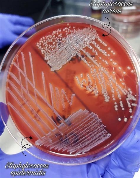 Staphylococcus epidermidis and Staphylococcus aureus : r ...