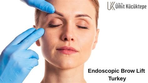 Endoscopic brow lift cost turkey before and after, Brow lift antalya