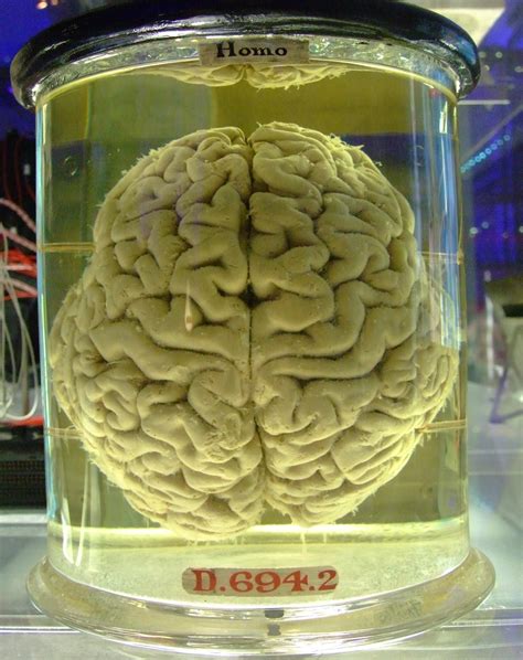 File:Human brain in a vat.jpg - Wikimedia Commons