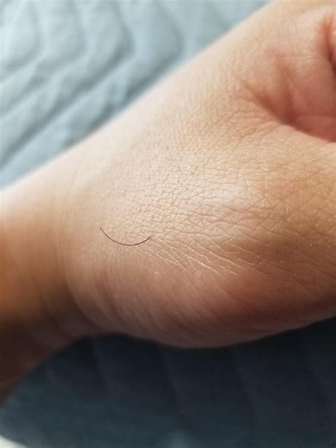 This lone hair growing on my hand. I pick them when it gets about this ...