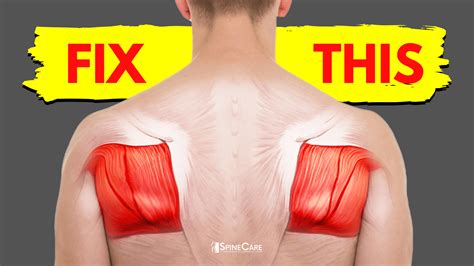 How to Fix Shoulder Blade Pain for Good | SpineCare