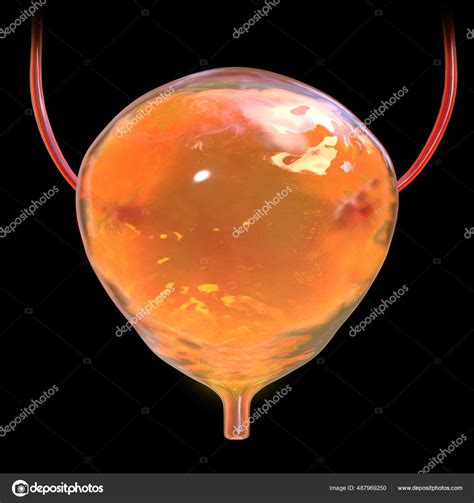 Vejiga Urinaria Ilustración Médica Anatomía Vejiga Urinaria Llena ...