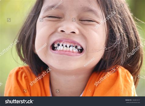 Child Tooth Decayed: Over 4,766 Royalty-Free Licensable Stock Photos ...