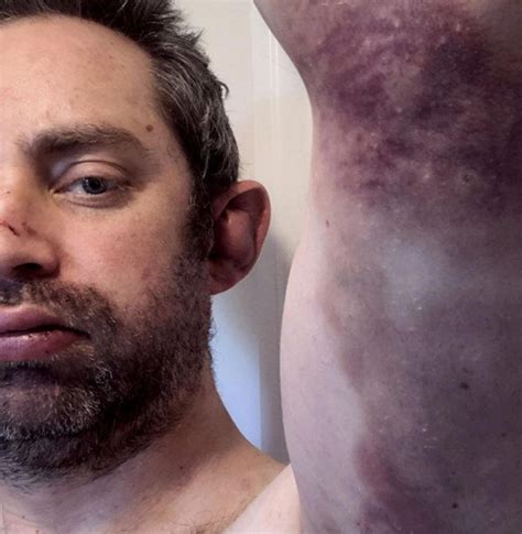 Richard Spencer case highlights female on male abuse, after 43 images ...