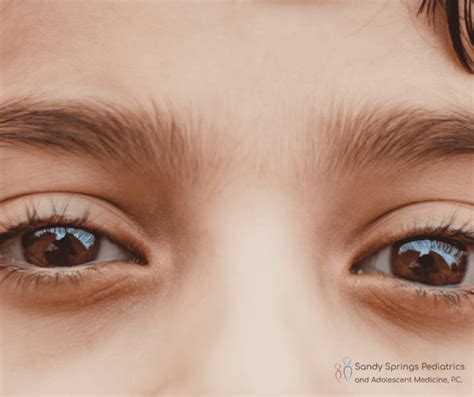 A Parent's Guide to Understanding "Eye Gunk" in Children