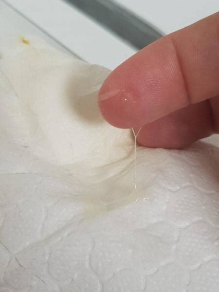 What is this type of discharge?