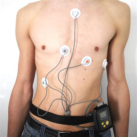 Co Wykrywa Holter EKG I Dlaczego Jest To Tak Ważne Badanie