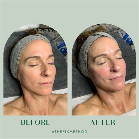 Three Reasons Your Clients Will LOVE This Facial Massage Technique