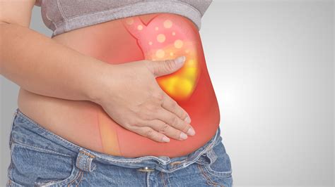 Descubre los mejores alimentos para aliviar la inflamación del estómago - Es Nutrición