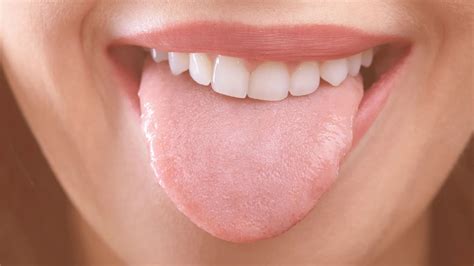 Teeth Marks On Tongue: Causes & Prevent At Spring Orchid Dental | Tongue health, Tongue sores, Teeth