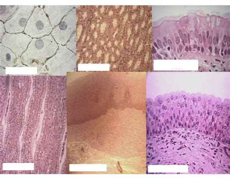 Epithelial Tissue Quiz